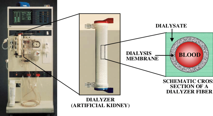 Cobe Centrysystem C3 Plus Dialysis System showing the dialysis machine components